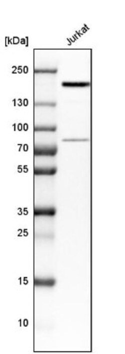 PRKCBP1 Antibody, Novus Biologicals 0.1mL; Unlabeled:Antibodies, Polyclonal