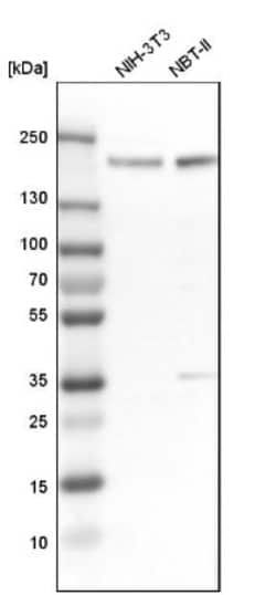 PRKCBP1 Antibody, Novus Biologicals 0.1mL; Unlabeled:Antibodies, Polyclonal