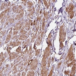 PRKCDBP Antibody, Novus Biologicals:Antibodies:Primary Antibodies