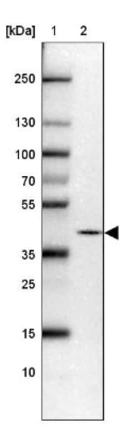 PRKCDBP Antibody, Novus Biologicals:Antibodies:Primary Antibodies