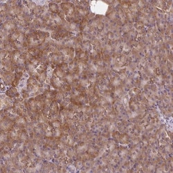 PRKCSH Antibody, Novus Biologicals 0.1mL; Unlabeled:Antibodies, Polyclonal
