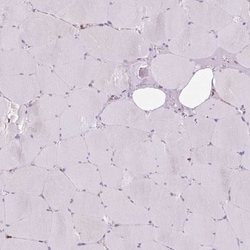 PRKCSH Antibody, Novus Biologicals 0.1mL; Unlabeled:Antibodies, Polyclonal