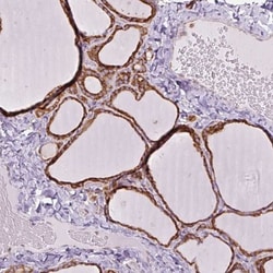 PRKCSH Antibody, Novus Biologicals 0.1mL; Unlabeled:Antibodies, Polyclonal