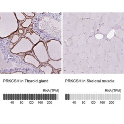 PRKCSH Antibody, Novus Biologicals 0.1mL; Unlabeled:Antibodies, Polyclonal