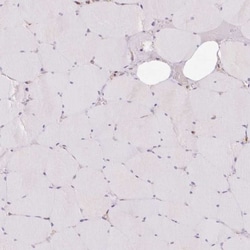 PRKCSH Antibody, Novus Biologicals 0.1mL; Unlabeled:Antibodies, Polyclonal