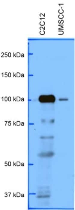 PRKD3/nPKC nu Antibody, Novus Biologicals 25 &mu;L; Unlabeled:Antibodies,