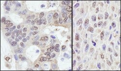 PRKRIR Antibody, Novus Biologicals 0.1mL; Unlabeled:Antibodies, Polyclonal