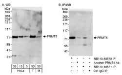 PRMT5 Antibody, Novus Biologicals 0.1 mL | Buy Online | Novus Biologicals | Fisher Scientific