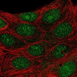 PRMT6 Antibody, Novus Biologicals:Antibodies:Primary Antibodies