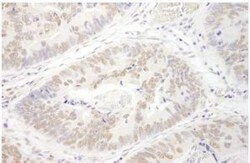 PRMT6 Antibody, Novus Biologicals 0.1mg; Unlabeled:Antibodies, Polyclonal