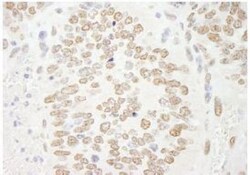 PRMT6 Antibody, Novus Biologicals 0.1mg; Unlabeled:Antibodies, Polyclonal