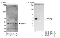PRMT6 Antibody, Novus Biologicals 0.1mg; Unlabeled:Antibodies, Polyclonal