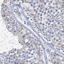 PROCA1 Antibody, Novus Biologicals 0.1mL; Unlabeled:Antibodies, Polyclonal