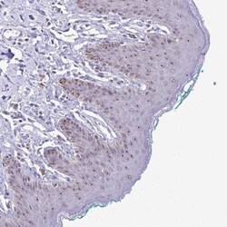 PROSER1 Antibody, Novus Biologicals:Antibodies:Primary Antibodies