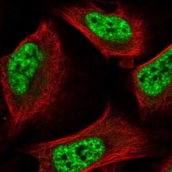 PRP19 Antibody, Novus Biologicals:Antibodies:Primary Antibodies