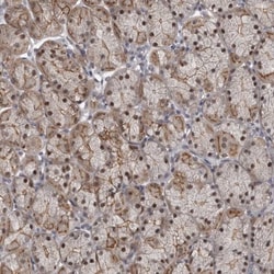 PRPF3 Antibody, Novus Biologicals 0.1mL; Unlabeled:Antibodies, Polyclonal
