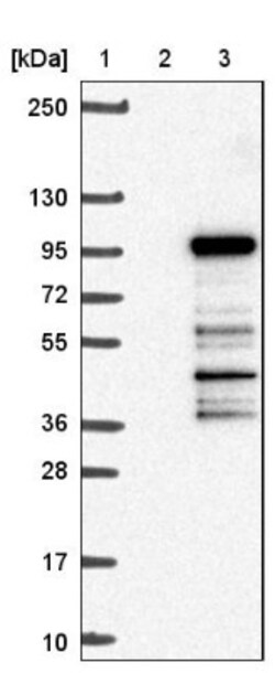 PRPF3 Antibody, Novus Biologicals 0.1mL; Unlabeled:Antibodies, Polyclonal