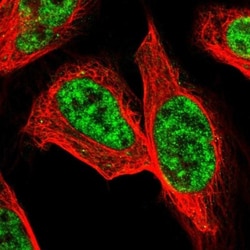 PRPF4 Antibody, Novus Biologicals 0.1mL; Unlabeled:Antibodies, Polyclonal