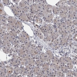 PRPF40B Antibody, Novus Biologicals 0.1mL; Unlabeled:Antibodies, Polyclonal