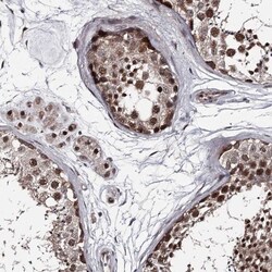 PRPF40B Antibody, Novus Biologicals 0.1mL; Unlabeled:Antibodies, Polyclonal