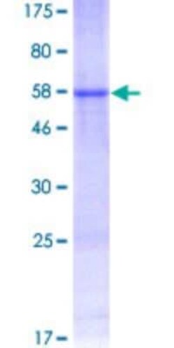 Novus Biologicals Recombinant Human PRPK GST (N-Term) Protein 10 &mu;g | Buy Online | Novus Biologicals&trade; | Fisher Scientific