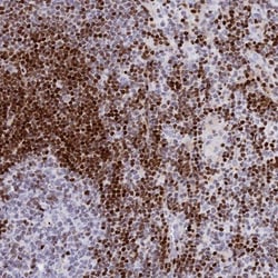 PRPS1 Antibody, Novus Biologicals:Antibodies:Primary Antibodies
