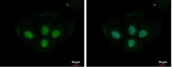 PRPS1L1 Antibody, Novus Biologicals 100 ul; Unconjugated:Antibodies, Polyclonal