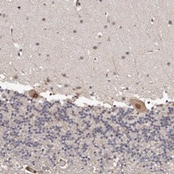 PRR12 Antibody, Novus Biologicals 0.1mL; Unlabeled:Antibodies, Polyclonal