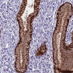 PRR15 Antibody, Novus Biologicals 25 &mu;L | Buy Online | Novus Biologicals | Fisher Scientific