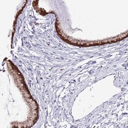 PRR15 Antibody, Novus Biologicals:Antibodies:Primary Antibodies