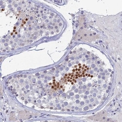 PRR22 Antibody, Novus Biologicals:Antibodies:Primary Antibodies