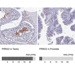 PRR22 Antibody, Novus Biologicals:Antibodies:Primary Antibodies