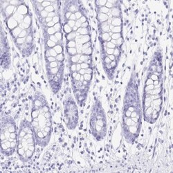 PRR4 Antibody, Novus Biologicals:Antibodies:Primary Antibodies