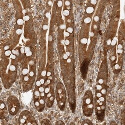 PRRC2C Antibody, Novus Biologicals:Antibodies:Primary Antibodies