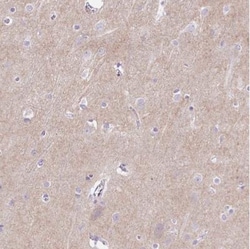PRRT1 Antibody, Novus Biologicals 0.1mL; Unlabeled:Antibodies, Polyclonal