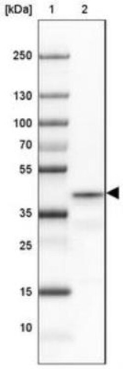 PRRT1 Antibody, Novus Biologicals 0.1mL; Unlabeled:Antibodies, Polyclonal