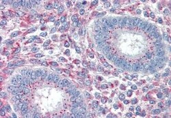 PRRX1 Antibody, Novus Biologicals 0.1mg; Unlabeled:Antibodies, Polyclonal