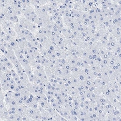 PRSS16 Antibody, Novus Biologicals 25 &mu;L; Unlabeled:Antibodies, Polyclonal