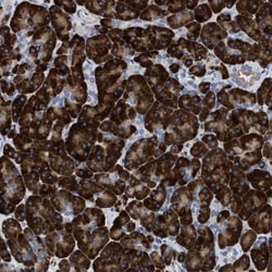 PRSS16 Antibody, Novus Biologicals 25 &mu;L; Unlabeled:Antibodies, Polyclonal
