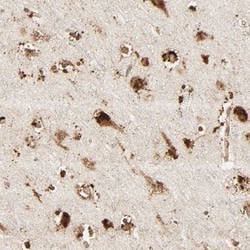 PSAP Antibody, Novus Biologicals:Antibodies:Primary Antibodies