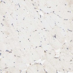 PSAP Antibody, Novus Biologicals:Antibodies:Primary Antibodies