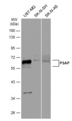 PSAP Antibody, Novus Biologicals 0.1mL; Unlabeled:Antibodies, Polyclonal
