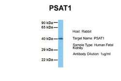PSAT1 Antibody, Novus Biologicals 0.05mg; Unlabeled:Antibodies, Polyclonal