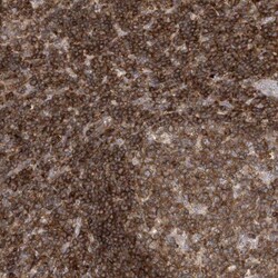 PSD4 Antibody, Novus Biologicals 25 &mu;L, Unlabeled:Antibodies, Polyclonal