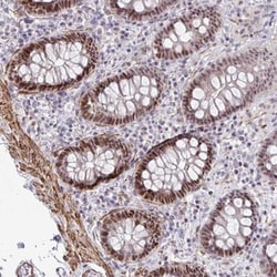 PSF2 Antibody, Novus Biologicals 0.1mL; Unlabeled:Antibodies, Polyclonal
