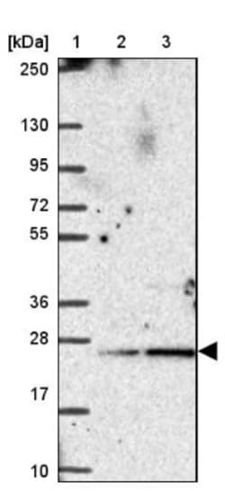 PSF2 Antibody, Novus Biologicals 0.1mL; Unlabeled:Antibodies, Polyclonal