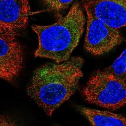 PSMB10/MECL1 Antibody, Novus Biologicals 25 &mu;L, Unlabeled:Antibodies,