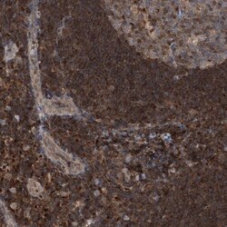 PSMB10/MECL1 Antibody, Novus Biologicals:Antibodies:Primary Antibodies