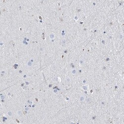 PSMB10/MECL1 Antibody, Novus Biologicals 25 &mu;L, Unlabeled:Antibodies,