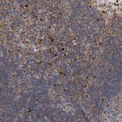 PSMB10/MECL1 Antibody, Novus Biologicals 25 &mu;L, Unlabeled:Antibodies,
